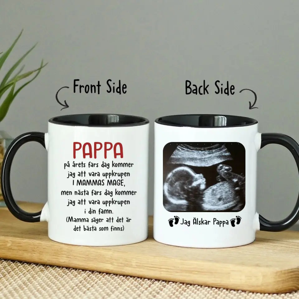 Personlig Mugg Till Blivande Pappa | Första Fars Dag Present | KaffeMugg Med Ultraljudsbild Av Bebis