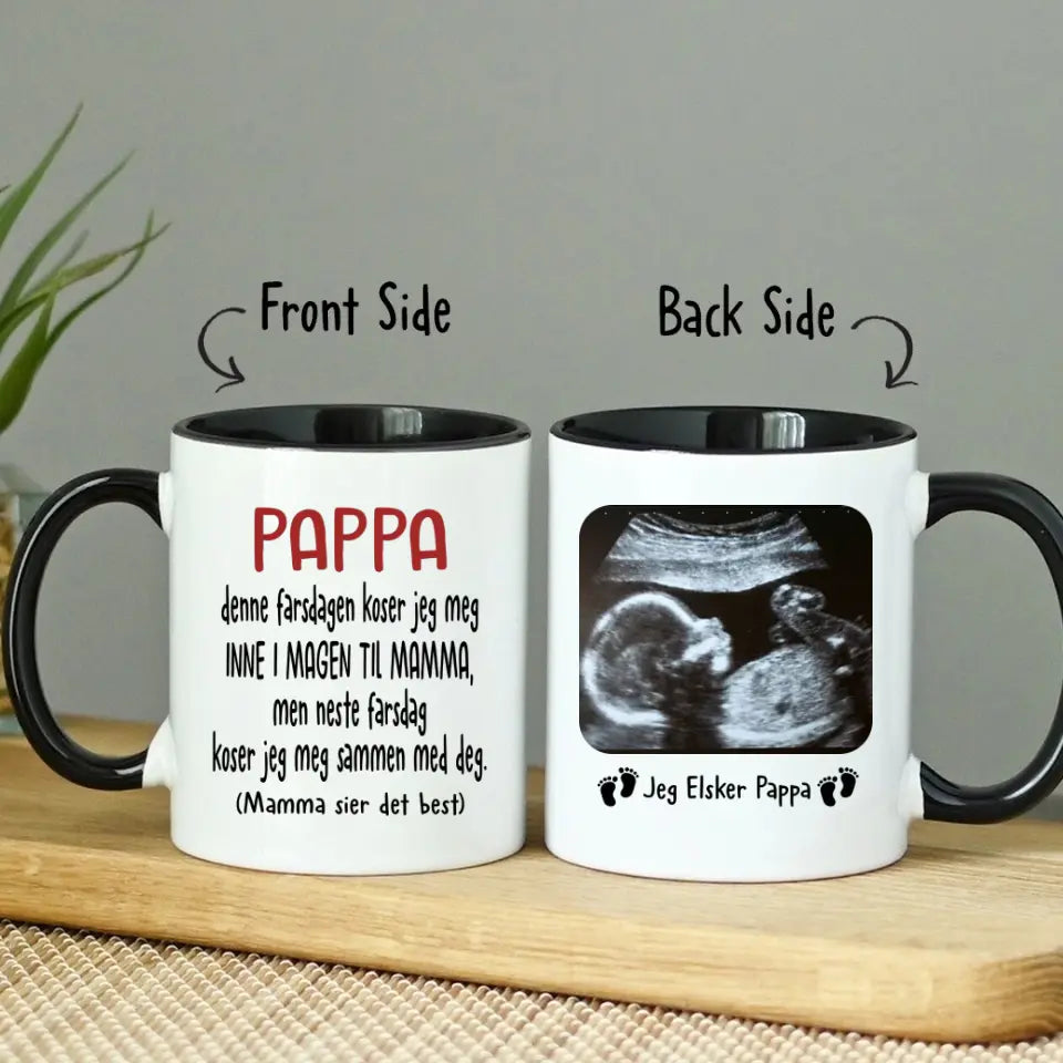 Personlig Krus Til Kommende Far | Første Farsdagsgave | Kaffekrus Med Ultralydbilde Av Babyen
