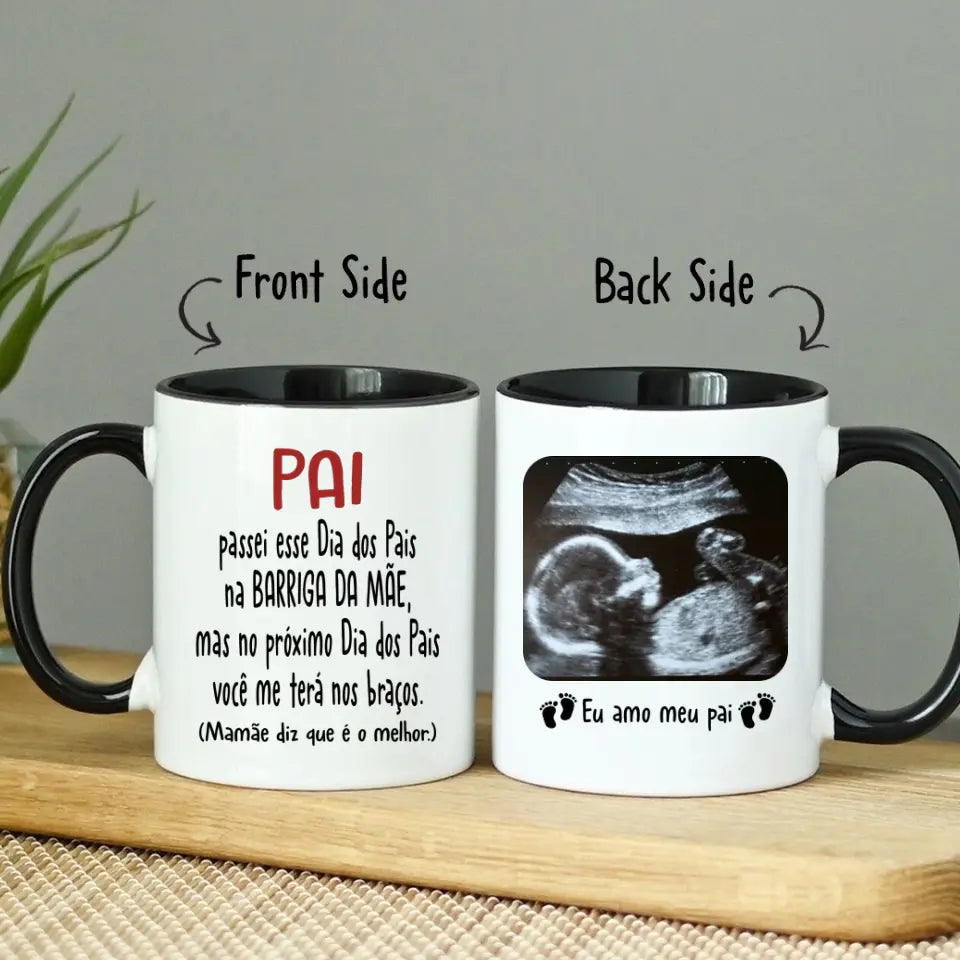 Caneca Personalizada Para Futuro Papai | Présente Primeiro Dia Dos Pais | Caneca De Café Com Imagem De Ultrassom De Bebê