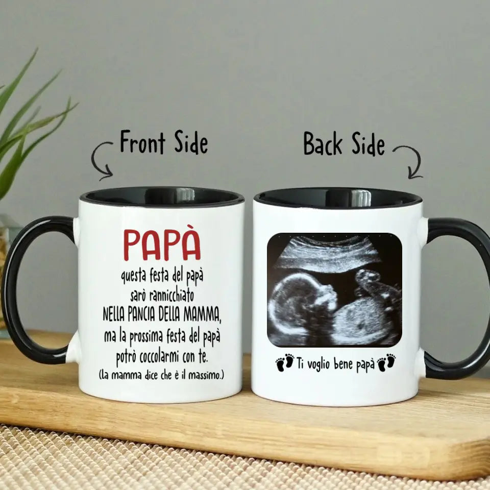Tazza Personalizzata Futuro Papà | Regalo Prima Festa Del Papà | Tazza Di Caffè Con L'immagine Ad Ecografia Del Bambino