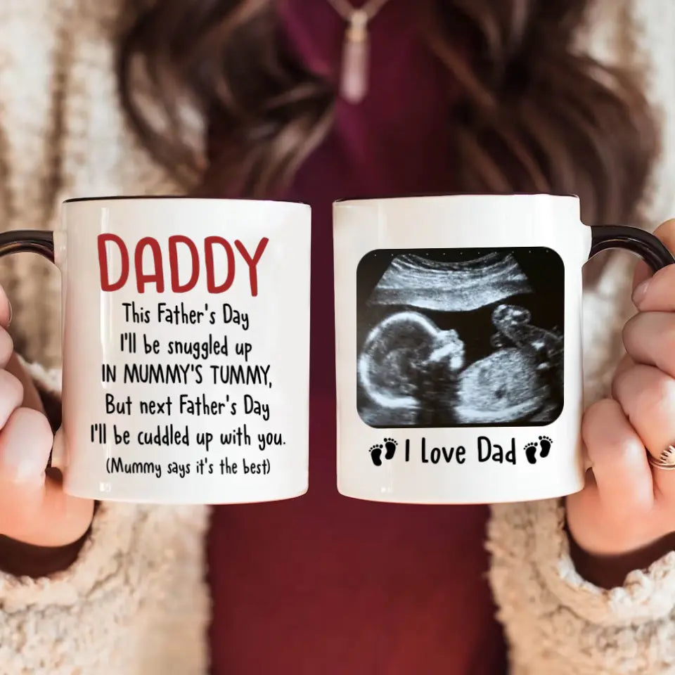 Custom Accent Mug For Dad To Be | First Father's Day Gift For Expectant Father | Personalized Coffee Mug With Ultrasound Picture
