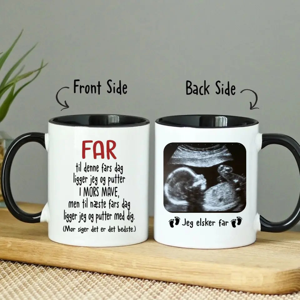 Personlig Krus Til Kommende Far | Første Fars Dag Gave | Kaffekrus Med Ultralydsbillede Af Baby