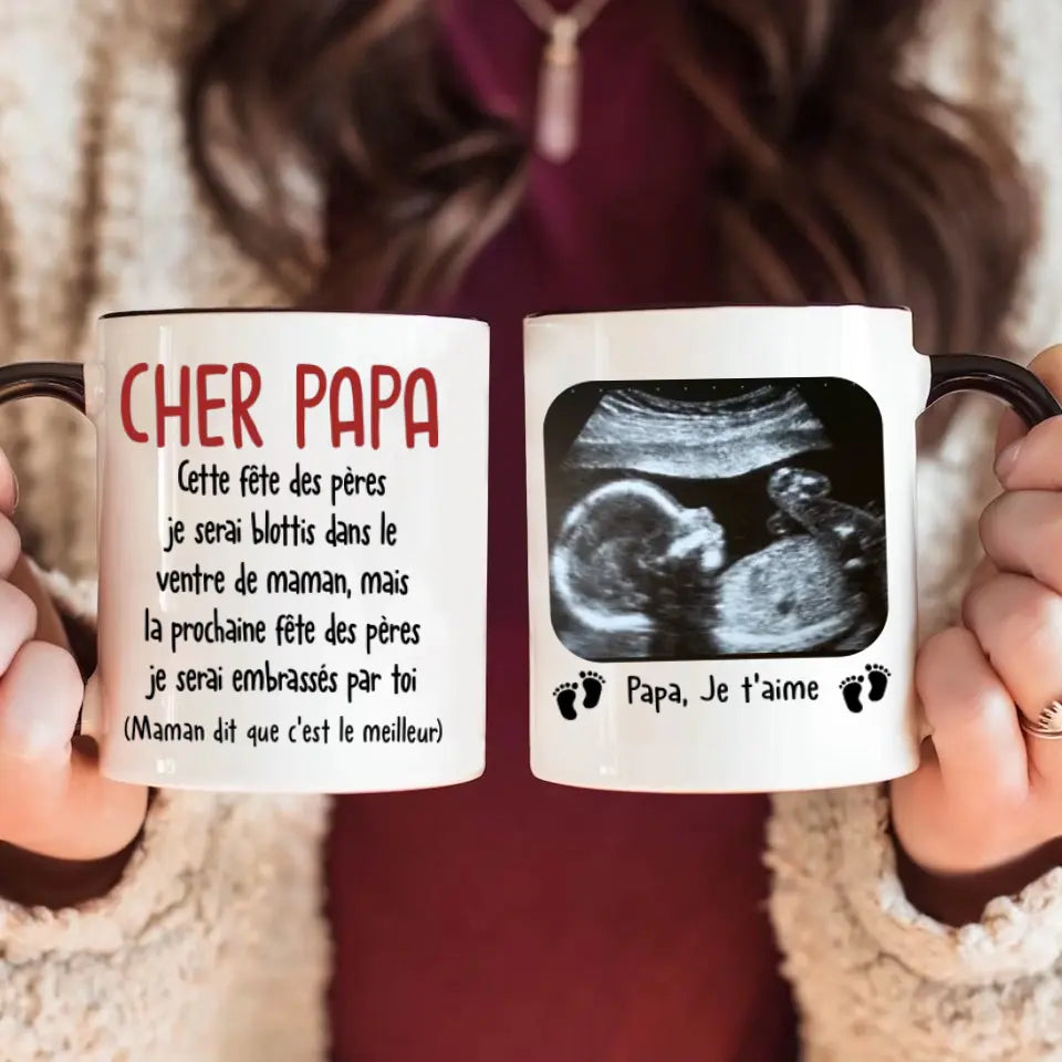 Mug Personnalisé Pour Futur Papa | Cadeau Premiere Fete Des Peres | Tasse Personnalisée Photo Échographique